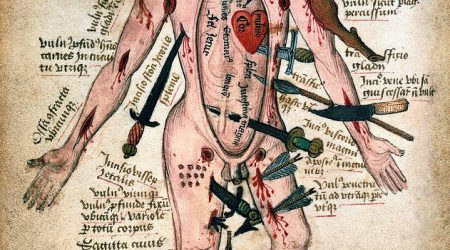 vijftiende eeuwse tekening van man met verwondingen aan de hand waarvan vergoedingen voor letsel werd bepaald
